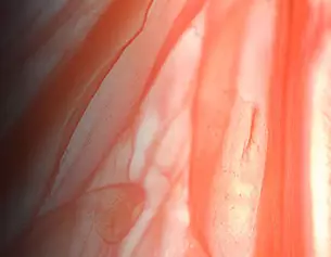 Myrixin Ingredient Image