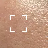 Uneven Skin Texture