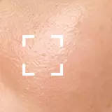 Combination Skin