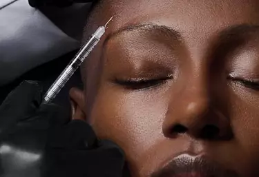 Adult Acne + Scarring