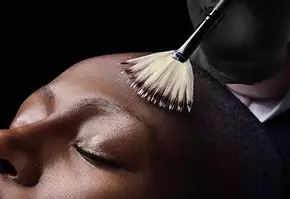 Light Chemical Peel Banner