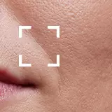 Anti-Aging