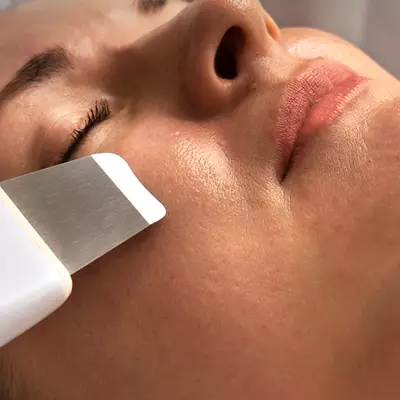 IPL Laser