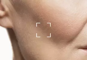 Facial Volume Loss Banner