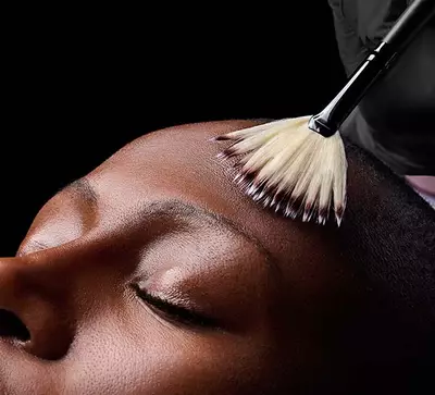 Medium Chemical Peel Hero Banner