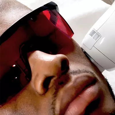 IPL Laser