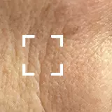 Fine Lines + Wrinkles