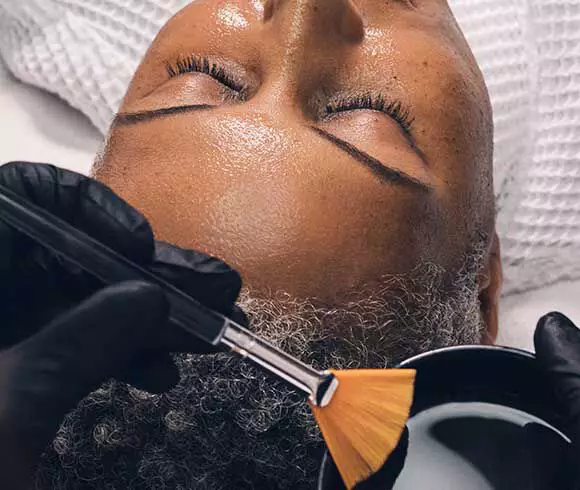 SkinCeuticals Smart TCA Peel