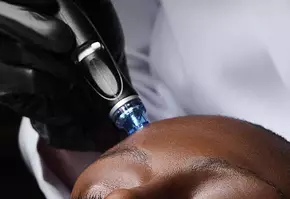 HydraFacial Banner